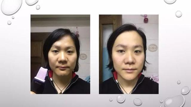 仪器说｜花1680元买黑金铲子对付黑白头？