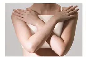 厉害了！广州这家中医院早期乳腺癌保乳率已超50%图片