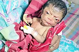 婴儿出生像80岁老人，父母精心照顾盼愿返老还童视频封面