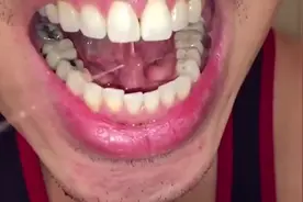 舌头底下能喷水，希望你看过后不要有什么不适