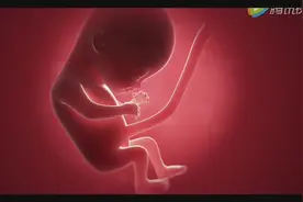孕妇产下罕见“胎中胎” 新生儿因“寄生胎”险丧命视频封面