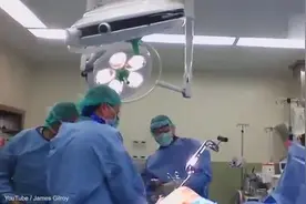 英国医生拆钢板手术视频流出，惊呆了！这哪是手术，简直在修车嘛图片