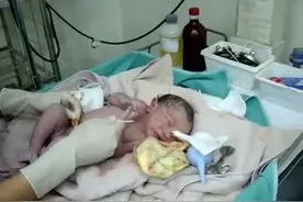 宝宝刚出生，就先来一泡尿，害的护士措手不及图片