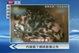 内窥镜下烟肺影像公布，吸烟者肺惨不忍睹