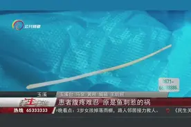 患者腹疼难忍 原是鱼刺惹的祸视频封面