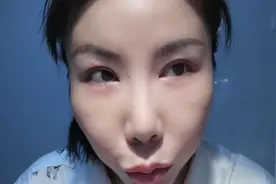 眼白变蓝靠坚持视频封面