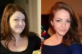 减肥前后脸部的变化，看完我惊呆了！图片