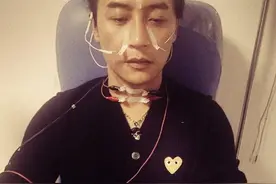 陈志朋为了北京个唱真是拼了 每天狂扎16针图片