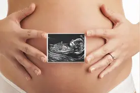 附睾畸形怎么回事 临床上如何治疗图片