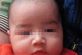 宝宝头上的头垢要正确清洗，切记千万不能用手抠！图片