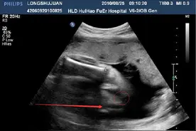 借助科学检验判断生男生女的方法图片