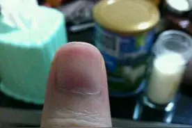 看孕妈左手大拇指能知道胎儿性别？（图）图片