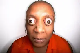 人体各个器官的世界之最，感叹道：还是做个正常的人好呀！图片