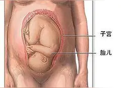 胎位不正怎么办？4个小妙招帮你解决你的困难。图片
