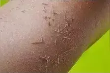 洗澡的时候，从你身上搓出来的“泥”到底是什么？图片