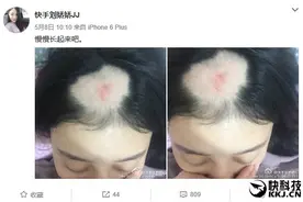 美女电钻啃玉米变秃顶去看医生：真悲剧了图片