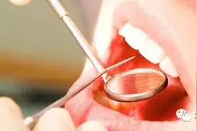 牙科“暴利”真的存在吗?其实真相是这样的！图片
