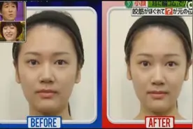 在耳朵上绑根皮筋就能起到瘦脸的效果，感觉效果很明显！视频封面
