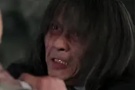 这竟然是个20岁的小伙？只因为他得了一种叫卟啉症的病！视频封面