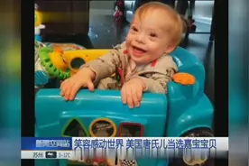 笑容感动世界 美国唐氏儿当选嘉宝宝贝