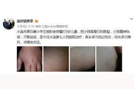 大连警方调查“小学生被教师殴打事件”，涉事人停课校长停职图片