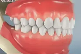 医学3D动画演示：智齿是如何拔除的？看着好酸爽