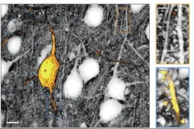 看看老鼠脑细胞间的空隙图片