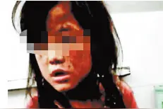 河池一男子将女儿绑在摩托车后拖行，警方将其抓获，事发原因是……图片