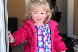 18个月女孩对水过敏 甚至流泪都会全身泛红图片