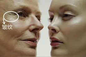 厉害！法令纹的克星竟是常见的“它”，坚持一个月，效果看的见~图片