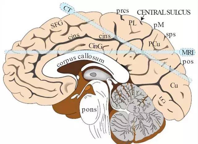 翼点的位置 翼点的位置图片