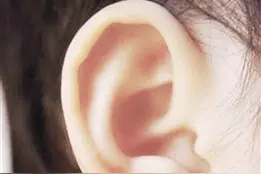 得了感冒后有些病要小心图片