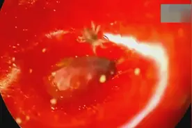 放大1000倍后的草莓  这寄生虫看得我都不敢吃草莓了视频封面