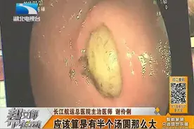 元宵节汤圆吃多了 堵住“通道”胀坏胃视频封面