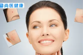 黑头粉刺怎么去除？这么好用的妙招，现在才知道！