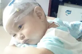 孩子频繁放臭屁？父母别大意，你家孩子可能得了这种病