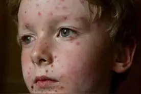 夏天到了，睡凉席一定要记得先除螨虫，除螨用这招真是神了！图片