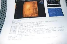孕育课堂：怀孕三十二周 胎儿发育与孕妈变化图片