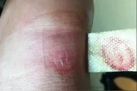 生活小妙招一：治疗皮鞋“打脚”有妙招！最后一招肯定管用！图片