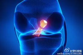 前交叉韧带损伤常见问题解答，前交叉韧带损伤的最佳治疗方法图片