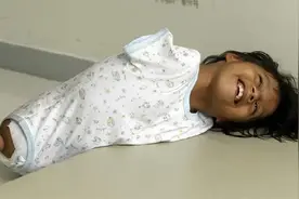 天生无四肢的小女孩，她的微笑让人动容图片