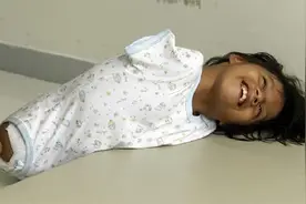 天生无四肢的小女孩，她的微笑让人动容图片