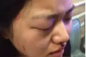 留学美女生因说中文被打骨折，竟然无人管！种族歧视让人心酸~图片