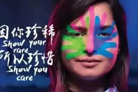 一年365天，有300天身上都是痛的……得了“罕见病”是怎样一种体验？图片