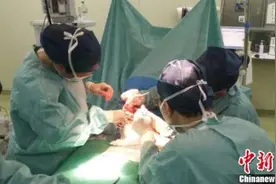 全球罕见的“三条腿”男婴在上海成功接受手术图片