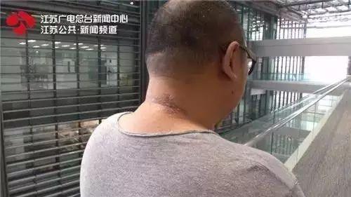 提醒|最近在家或外出都要小心它!一周内已有多人中招进医院……