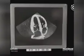 医学3D动画演示：2分钟看懂心脏超声心动图，俗称心脏彩超