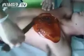 蜜蜡脱毛过程，看得我皮一痒一痒的图片