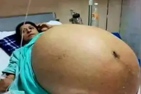 这生娃能力真没谁了，肚子都要撑破了！图片