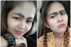 泰女子纹眉失败留下黑粗浓眉 做激光清除手术图片